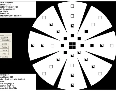 Figure 1Subject view of the MMT resultsSubject view of the MMT results. Black squares indicate letters that were not seen, half-shaded squares indicate those that were seen but not correctly identified, and white squares indicate letters that were correctly identified.