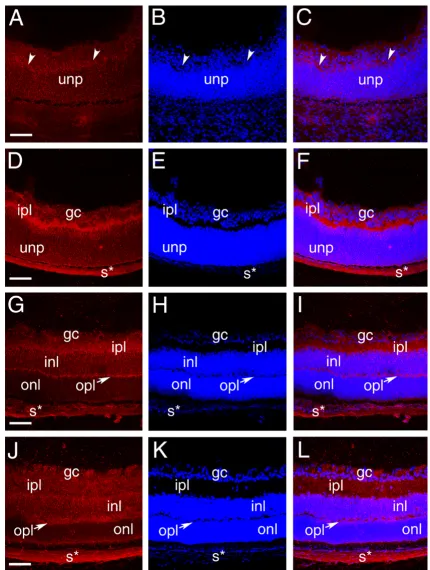 Figure 4layerstaining in the sclera; inl- inner nuclear layer; opl- outer plexiform layer; onl- outer nuclear layer