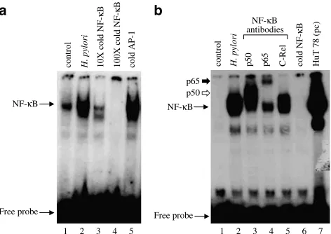 Figure 2CAPE inhibitsunder Methods section). Experiments were performed three timesfor a further 2 h