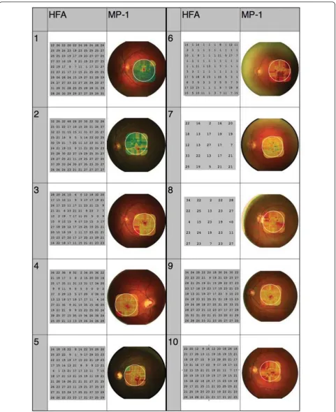 Figure 2 Results from both instruments for each subjectpoint within the visual field (larger numbers show better function)