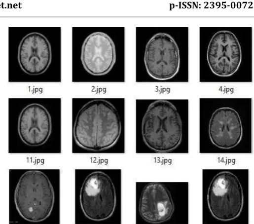 Fig -5: Initial processing 