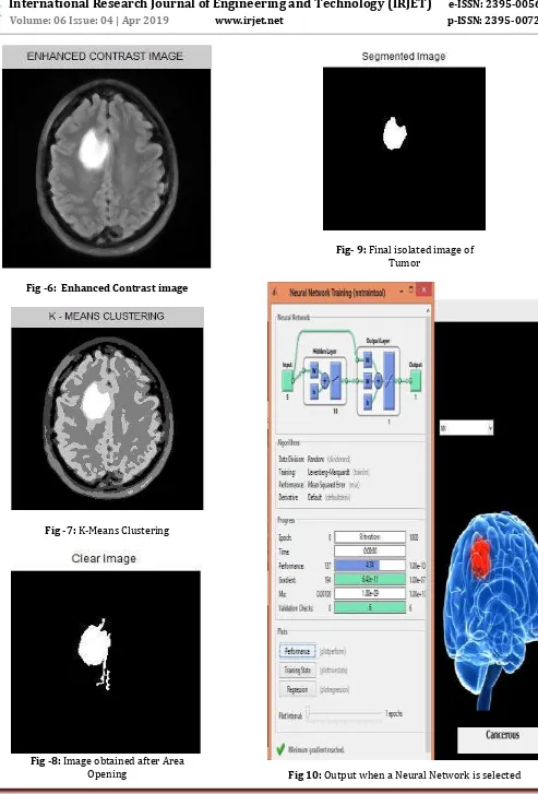 Fig 10: Output when a Neural Network is selected 