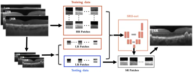 Fig. 1. Flow chart of our overall approach. We train the network with correspondinglow- and high-resolution image patches