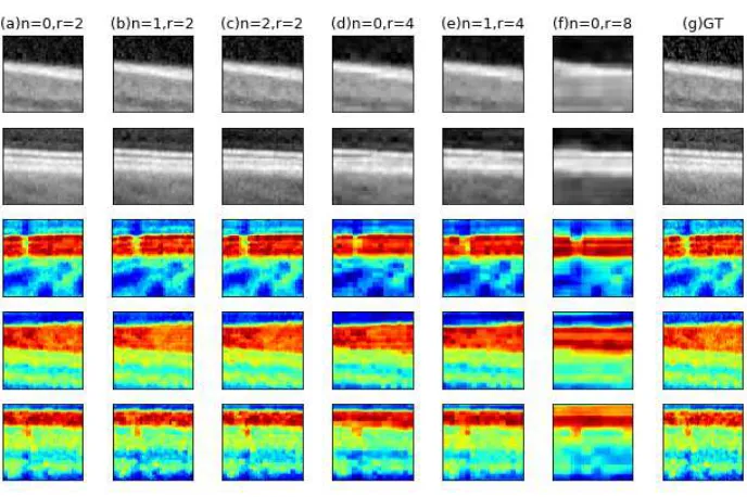 Fig. 3. Examples of our test results. Columns (a)-(c) show examples of 2x SR, columns(d)-(e) show 4x SR, column (f) shows 8x SR and (g) shows the ground truth HR patchwhich we aim to approximate
