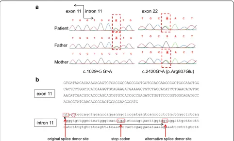 Fig. 1 Mutations detected in the ATP6V0A4 gene. a Left; A heterozygous single-base substitution of G to A in intron 11 (C.1029 + 5A > G) wasdetected in the paternal allele