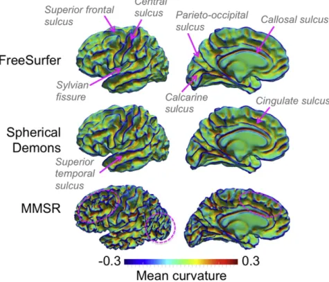 Fig. 5. Comparison of the group average of the source surfaces' mean curvature H mapped onto the average white matter surface for the three registration techniques
