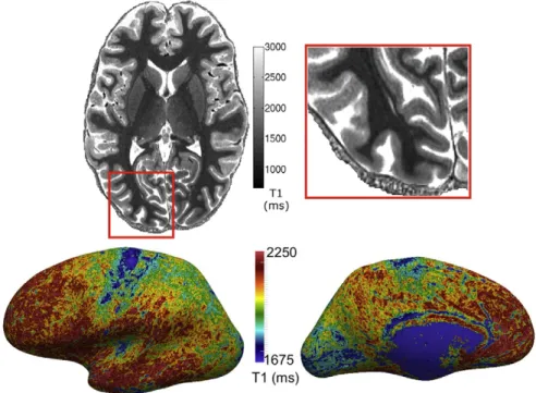Fig. 8. 0.5 mm isotropic T1 map acquired using the MP2RAGE sequence at 7 T. The T1 map exhibits intra-cortical contrast between cortical areas and cortical layers