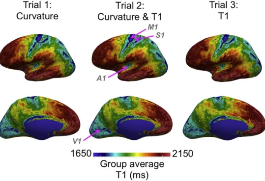 Fig. 10. Multiple views of the group average T1 maps created using three different contrast combinations