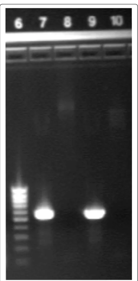 Figure 1 OX40L gene identification by PCR. PCR performed onpurified plasmid with and without OX40L insert