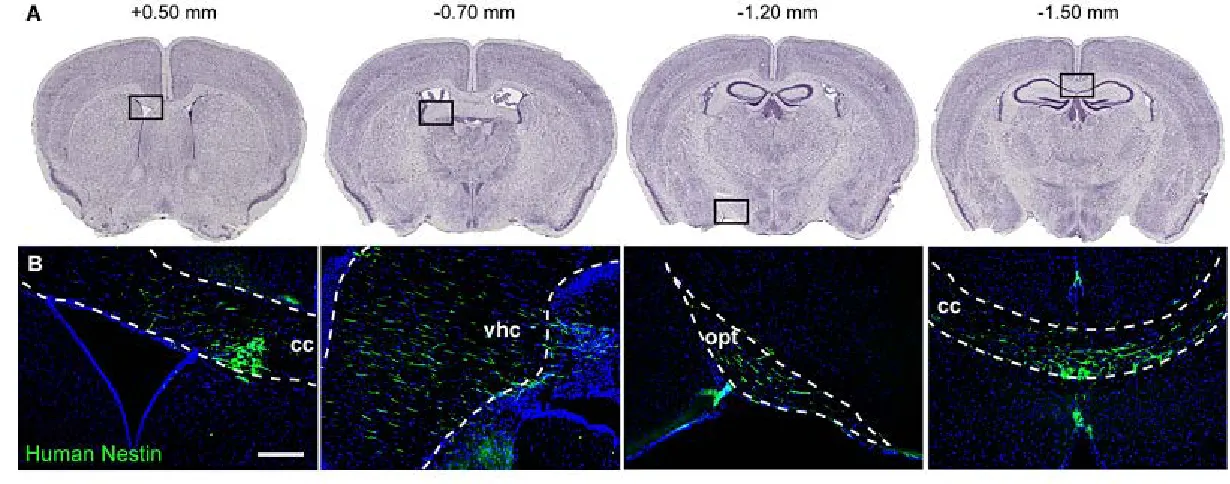 Figure 3.3 MPS VII iPSC-NSCs survive and retain nestin expression four months following intraventricular injection