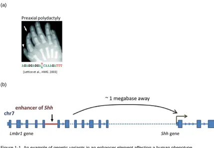 Figure 1-1. An example of genetic variants in an enhancer element affecting a human phenotype