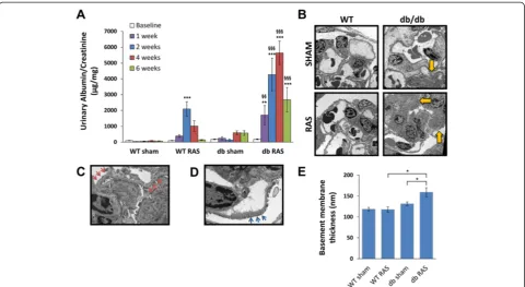 Figure 4 Db RAS mice developed albuminuria to a greater extent that the WT RAS mice. Amembrane thickness of db RAS compared to WT RAS and db sham