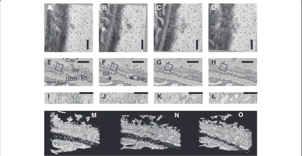 Figure 7 Tomographic reconstruction of rat glomerular capillary glycocalyx using LaDy GAGa staining on a 300 nm thick section