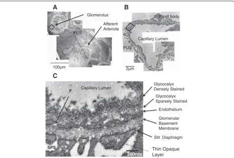 Figure 1 Structure of the glomerular filtration barrier.stain (section 80 nm thick).glomerular filtration capillary (boxed inThere are two layers of staining (dense and sparse) present in this example of endothelial glycocalyx