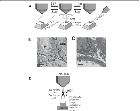 Figure 2 Illustration of methods for SBF-SEM, FIB-SEM and Tom-TEM. A: Illustration of the imaging procedure for SBF-SEM and FIB-SEM
