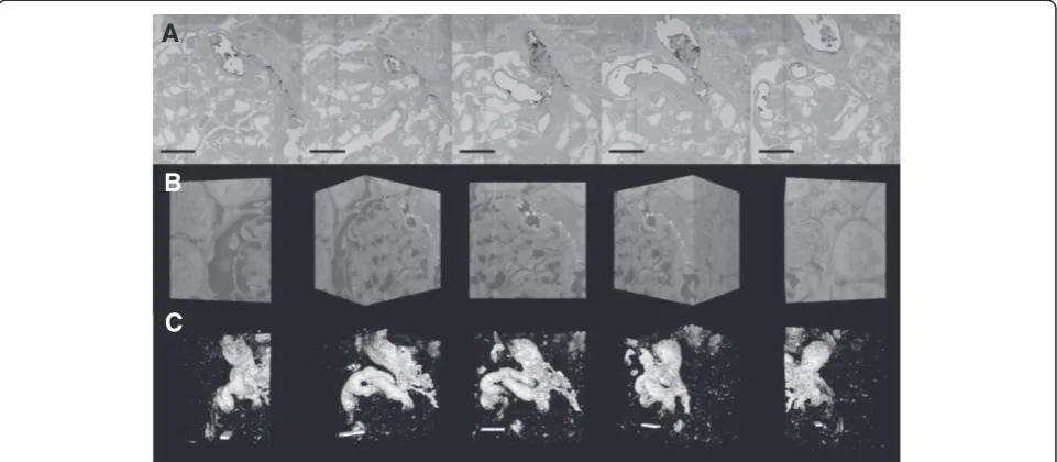Figure 3 SBF-SEM contrast imaging of glomerular glycocalyx. AThe LaDy GAGa stained components can be seen as dark regions adjacent to the lower contrast of a conventionally processed TEM resin block(Additional file 2: Movie S3A).: Section sequence (every 7