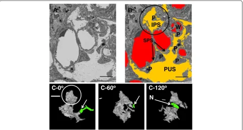 Figure 5 The IPS in human glomeruli. A: Example SBF-SEM micrographs of the human glomerulus (Additional file 9: Movie S5A)