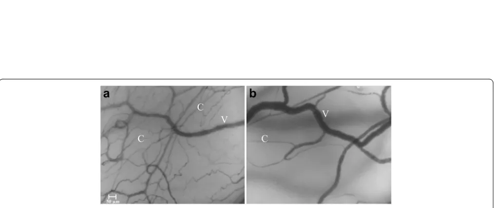 Fig. 1 Conjunctival and sublingual microcirculation data of brain dead patients and control group TVD- total vessel density; PVD- perfused vesseldensity; MFI- microvascular flow index