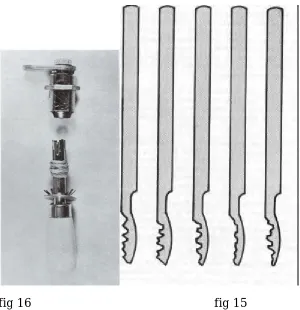 fig 16                                                  fig 15