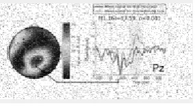 Fig -1: Salt and pepper Noise in an image 