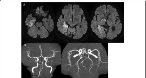 Fig. 4 Postoperative MRI/MRA. a There were no new acute ischemic lesions on postoperative MRI DWI