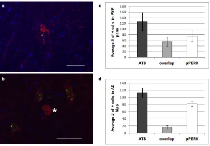 Figure 2.5 Hyperphosphorylated tau and pPERK partially co-localize in PSP pons and AD hippocampus
