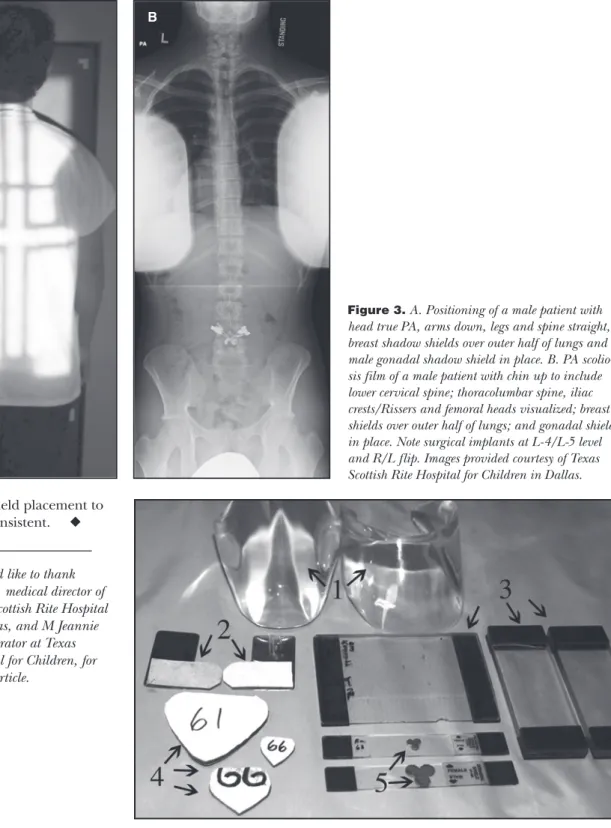 Figure 4.  Sample scoliosis supplies are cervical spine collar filter (1), breast shadow shields  (2), wedge filters (3), contact gonadal shields (4) and shadow gonadal shields (5).