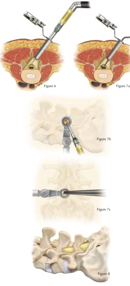 Figure 6 Figure 7a