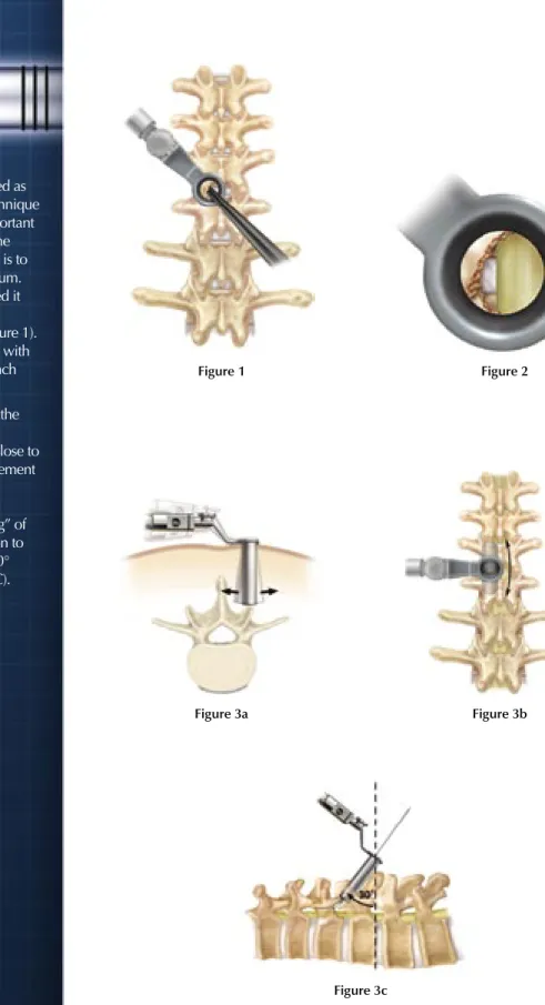 Figure 3a Figure 3b