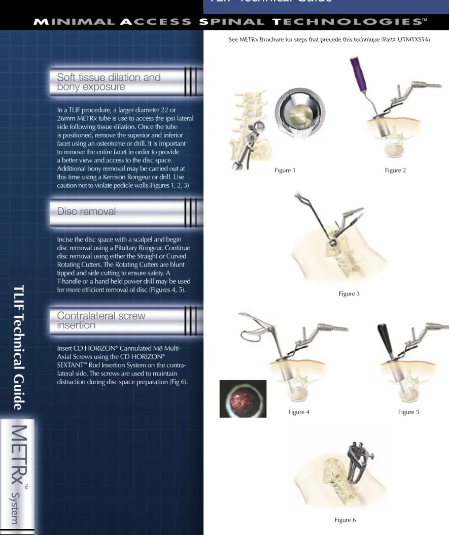 Figure 1 Figure 2