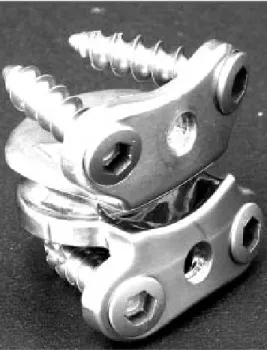 Figure 4: Cervicore TM  (SpineCore, Summit, USA) metal-on-metal design  having a saddle-shaped bearing surface 
