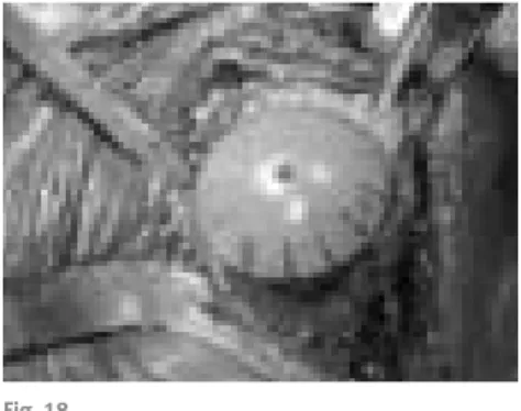 Fig. 19Fig. 18