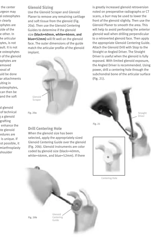 Fig. 20b Glenoid  Centering  Guide Fig. 21 Centering HoleGlenoid Sizing