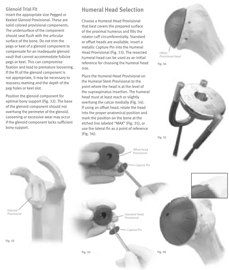 Fig. 32 Glenoid  Provisional