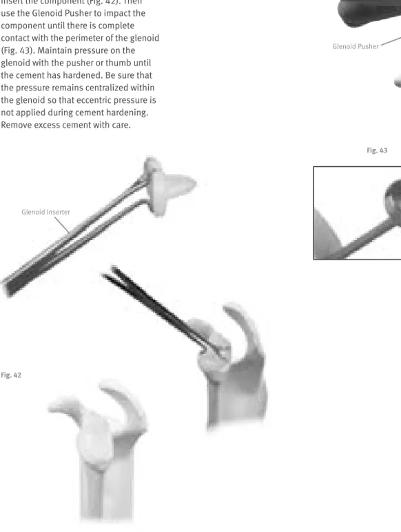 Fig. 43Glenoid Pusher