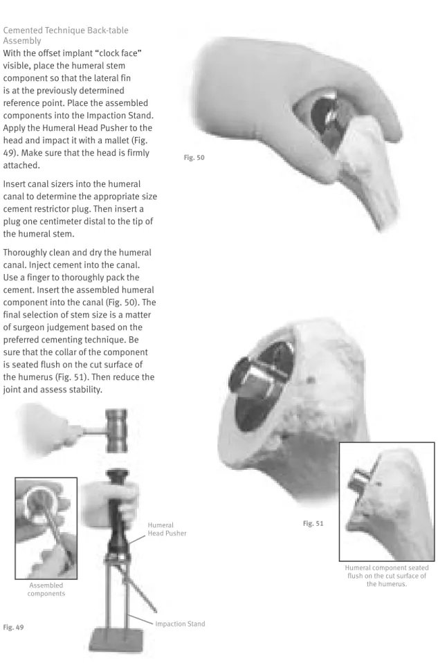 Fig. 49 Humeral   Head PusherAssembled components Fig. 50 Impaction Stand