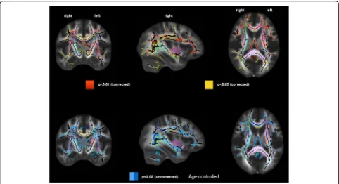 Fig. 3 Difference in white matter damage assessed by fractional anisotropy in prevalent hemodialysis patients, separated by number ofright columnPastel colorscardiovascular risk factors (zero or one vs more than one) compared to controls without kidney dis