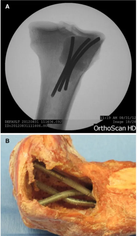 Fig. 3 Plated specimen undergoing compression testing in MTSmachine