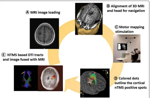 Fig. 1 The procedure of nTMS motor mapping and image of nTMS-based DTI tracts. (A) Upload T1-weighted image