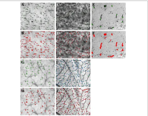 Figure 4 Typical errors in automatic counting.horizontal cells are generally well differentiated, and even S-cones positioned directly above a horizontal cell are correctly recognized (middle left).(I,J)counted as cells