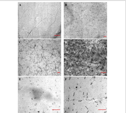 Figure 1 Examples of retinal micrographs used in the experiments.cells labeled.(A) The scale, indicated by the red bar, is 500 μm in (A) and 50 μm in (B)–(F)