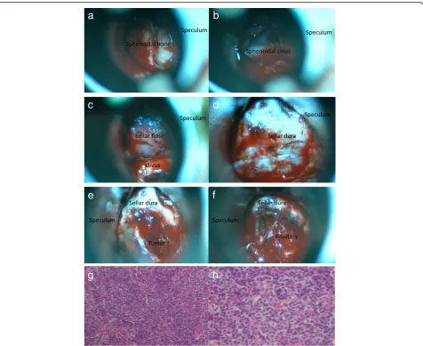 Table 2 Size of tumor
