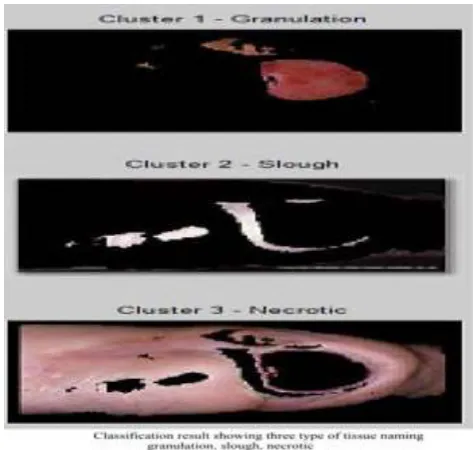 Fig -2: Input image of wound tissue detection and classification                The operations of image preprocessing applied on 
