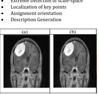 Fig -7: (a)input brain image ,(b)Filtered DBCWMF image  