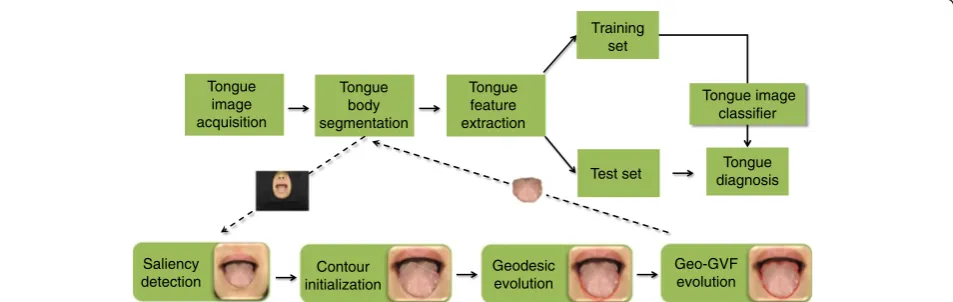 Figure 1 Outline of a computerized model for tongue diagnosis and a flowchart of the proposed DGF for tongue image segmentation.
