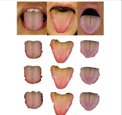 Figure 5 Examples of tongue image segmentation.(white curves); second row: corresponding segmentation results of the first row; third row: segmentation results of C Top row: refined tongue images and final propagating results of the proposed DGF2G2FSnake [19]; fourth row:segmentation results of double snakes [17].