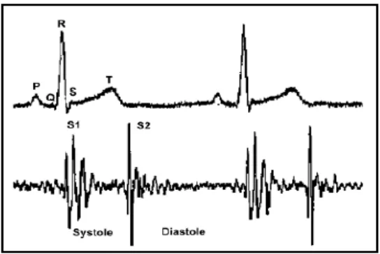 Figure. 2 The Correlation between ECG and Heart Sound Signal 