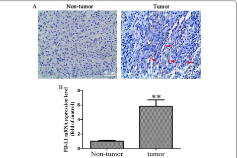 Fig. 1 Increased PD-L1 expression level in OS tissues.level of PD-L1 in OS and OS-adjacent tissues ( a Immunohistochemical assay was performed to detect the expression of PD-L1 in OS andOS-adjacent tissues (× 400 magnification), the red arrow represents po