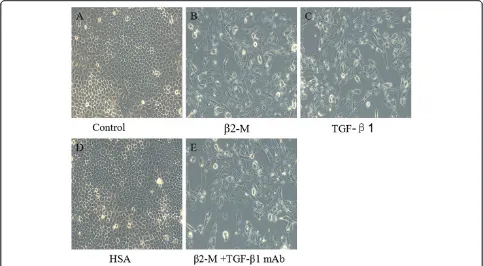 Figure 1 Effects of β2-M treatment on the viability of HK-2 cells.HK-2 cells were grown to 80% confluence, and then, differentconcentrations of β2-M (5, 10, 25, and 50 μM) were added to themedia for an additional 24, 48, and 72 h