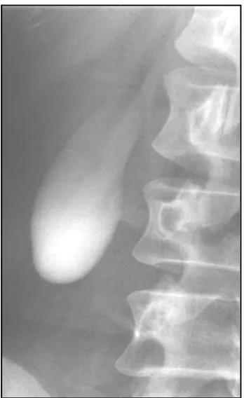 Figure 18: Oral cholecystography 